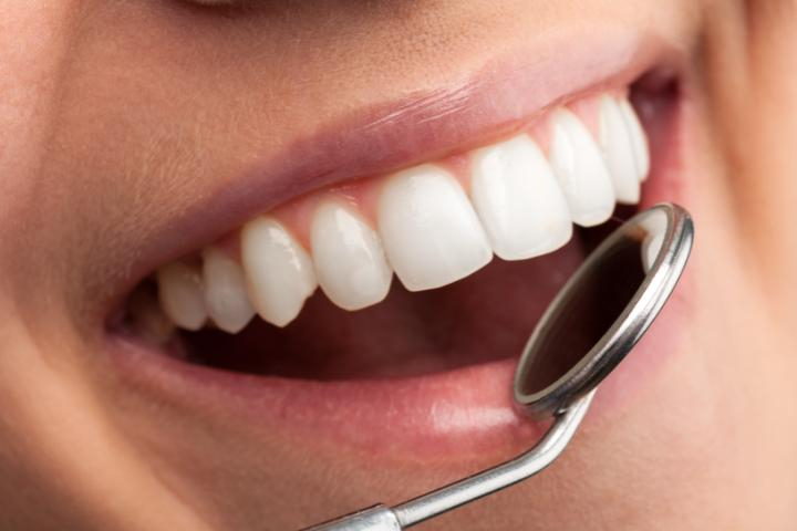Palavras-Chave para Dentistas: Ferramenta de Palavras-Chave do Google