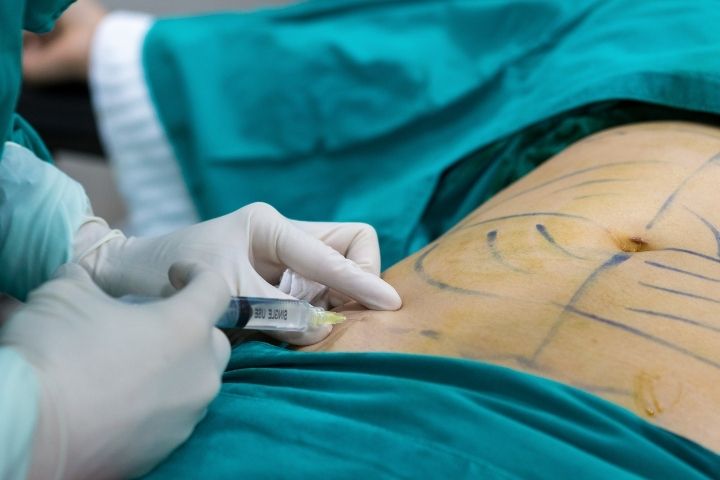 Cirurgia Plástica